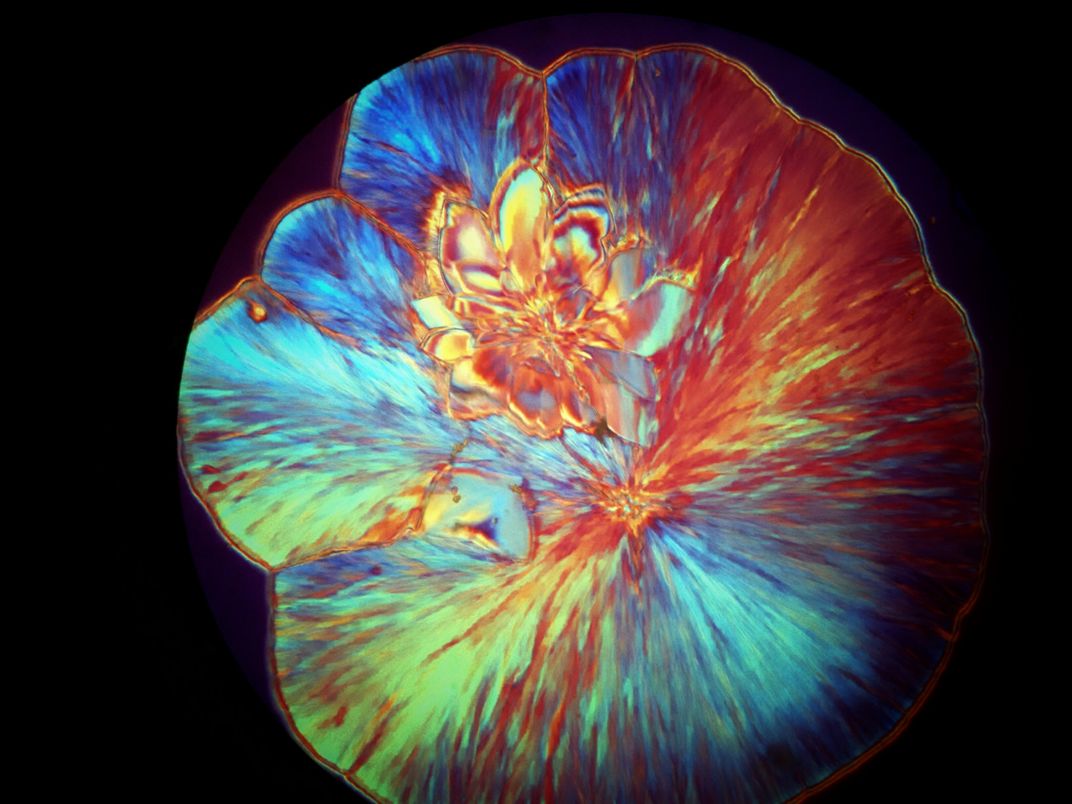 Photomicrograph of a urine crystal using polarized light from a small ...