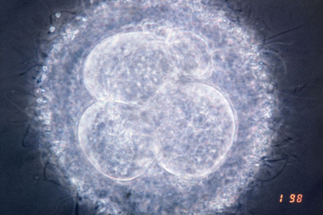 human embryo