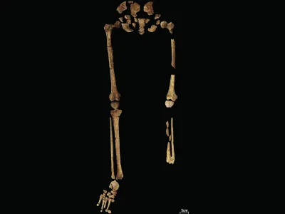 未被发现的骨架显示了左腿胫骨和腓骨被截去的位置。