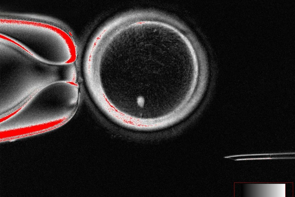 egg with human skin cell before fertilization