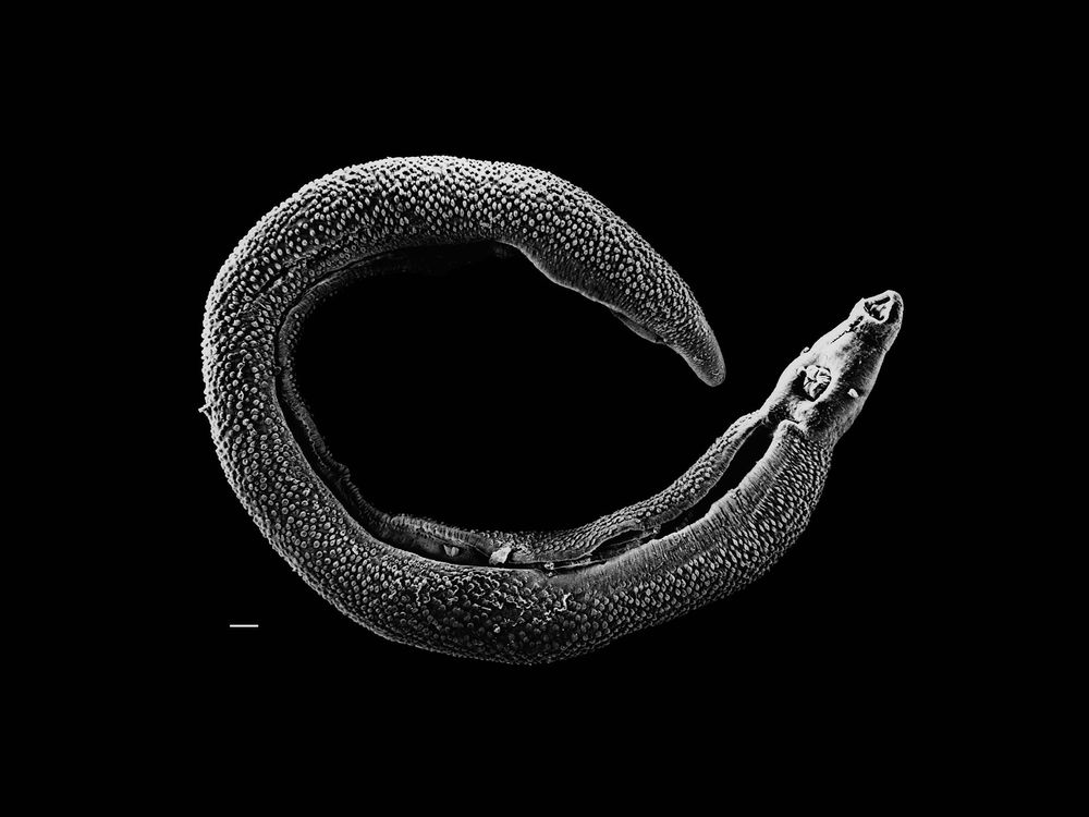 Schistosoma_20041-300.jpg