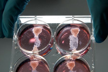 Samples of cultured meat grown in a laboratory are seen at the University of Maastricht on November 9, 2011. Scientists are cooking up new ways of sustainably feeding the world's hunger for resource-intensive foods like meat products.