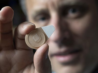 Mark Prausnitz holds an experimental microneedle contraceptive skin patch. Designed to be self-administered by women for long-acting contraception, the patch could provide a new family planning option.