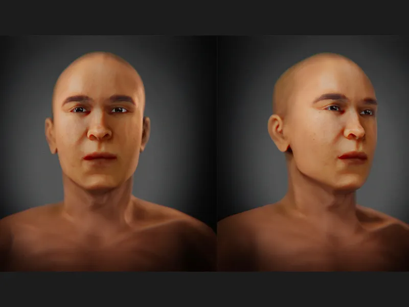 Facial Reconstruction