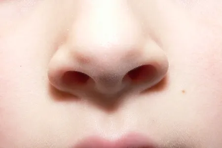 The lack of a sense of smell, called anosmia, can be congenital or acquired at some point in a person&#39;s lifetime.