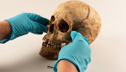 Whalers Didn’t Just Sing Sea Shanties and Seek Adventure. Proof of Laborers' Grueling Work Is in Their Skeletons, Buried in the Arctic