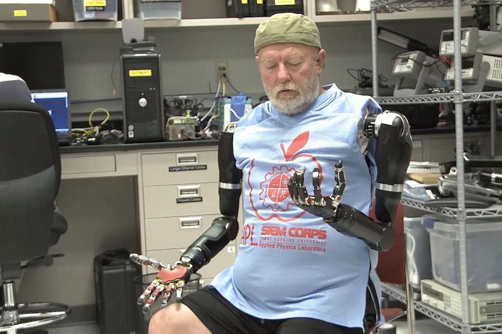 Baugh's robotic arms