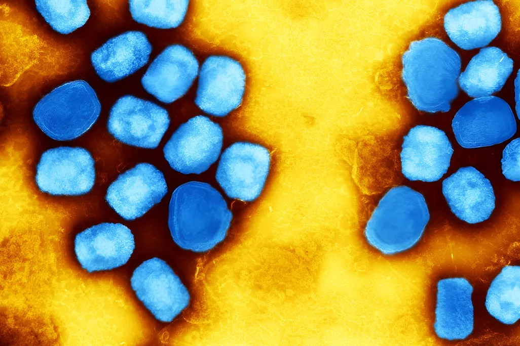 Blue mpox viral particles on a yellow background