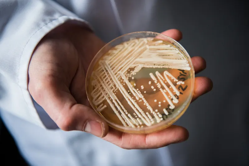 person hold petrie dish with candida auris