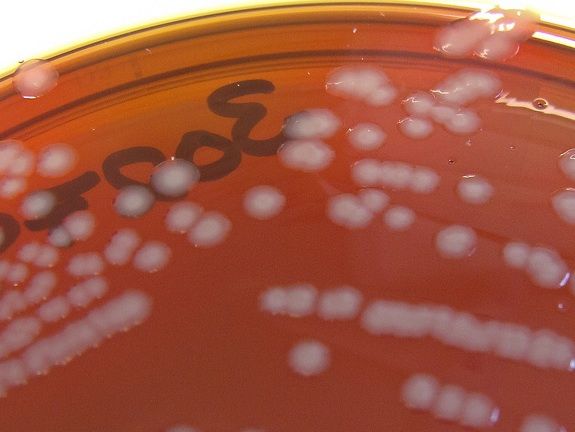 A gonorrhea culture