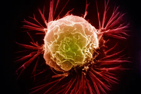 The way cancer cells process zinc might help scientists identify a new biomarker. 