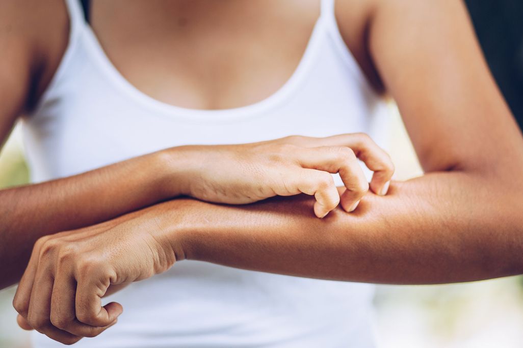 Chronic Itching