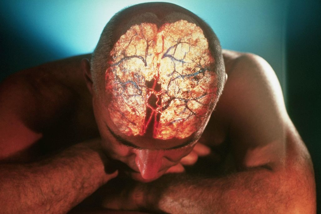 brain image
