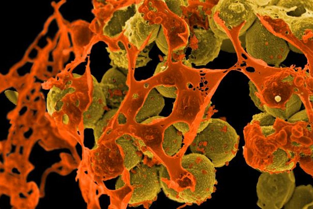 MRSA