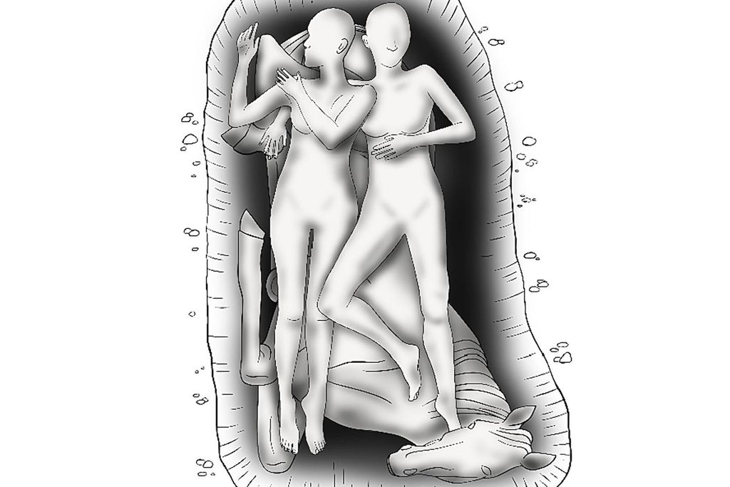 reconstruction