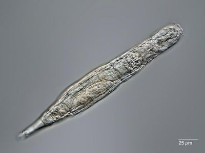 A rotifer seen under a microscope.