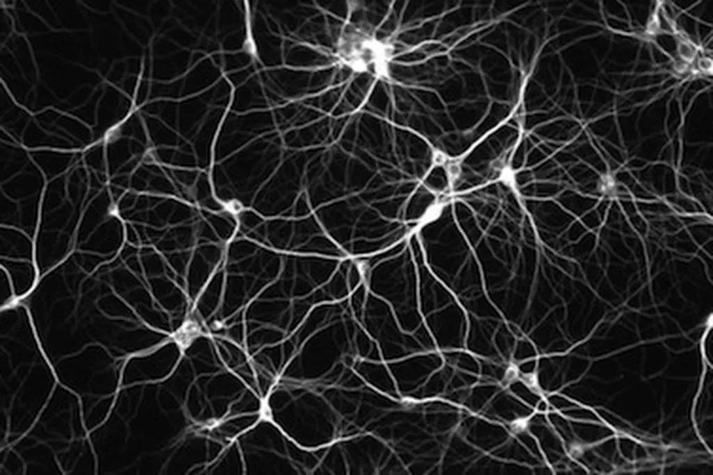 When neurons misfire