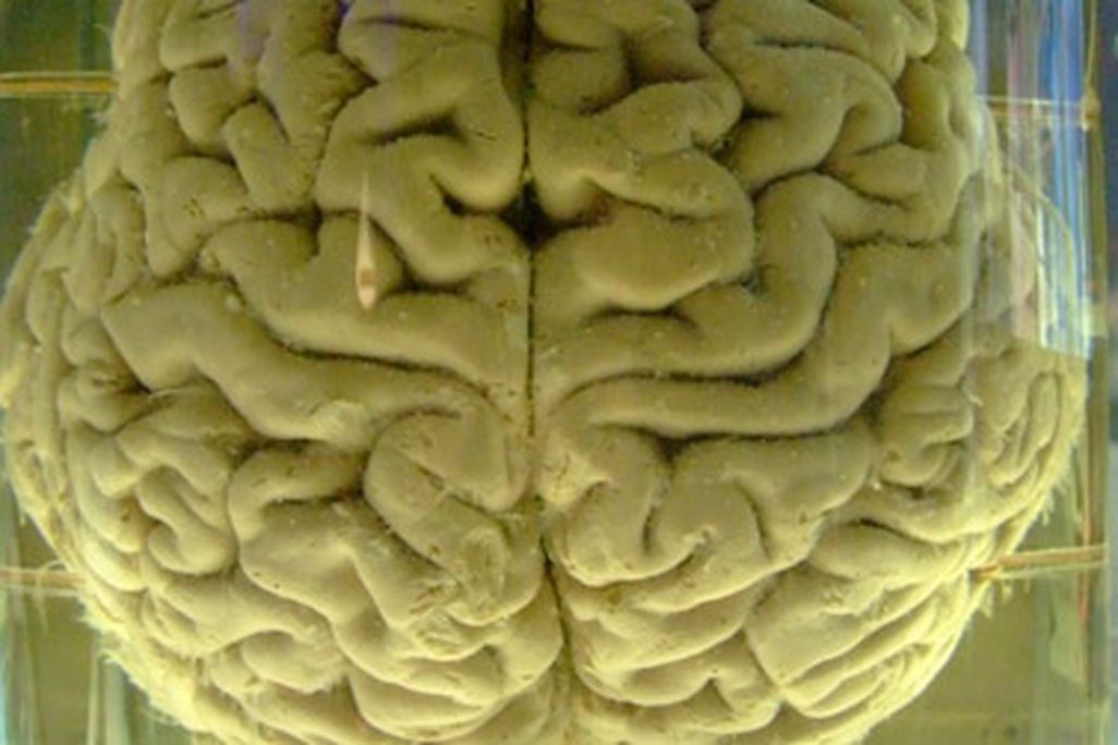 Computers are coming closer and closer to mimicking the human brain.