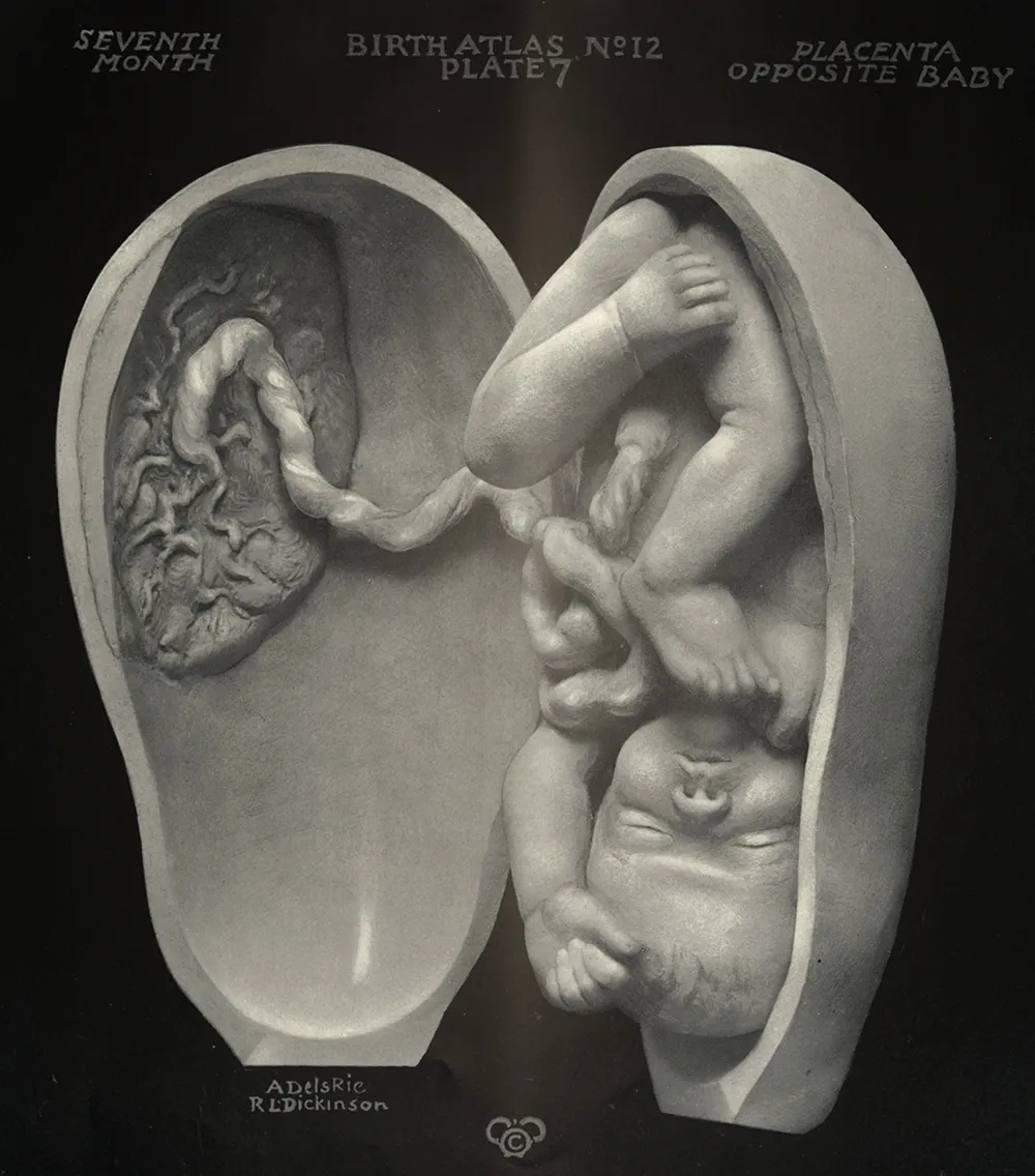 Plate 7 from the Birth Sculpture series shows a fetus at seven months of gestation