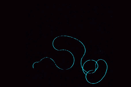 A time-lapse of an individual D. melanogaster sperm cell. The head is artificially colored pink, and the tail is teal.