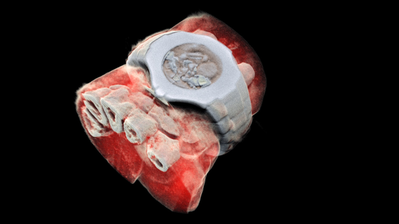 Check Out These Awesome New 3D, Full-Color X-Rays