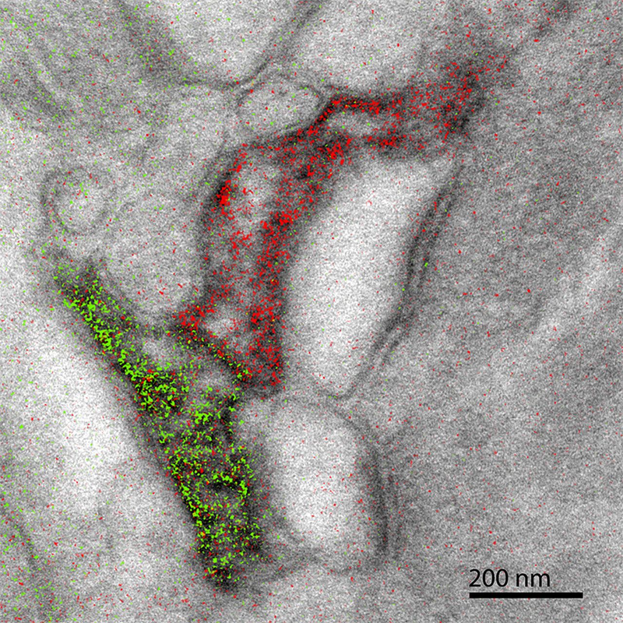 Electron Microscope Color Google Search Microscopic