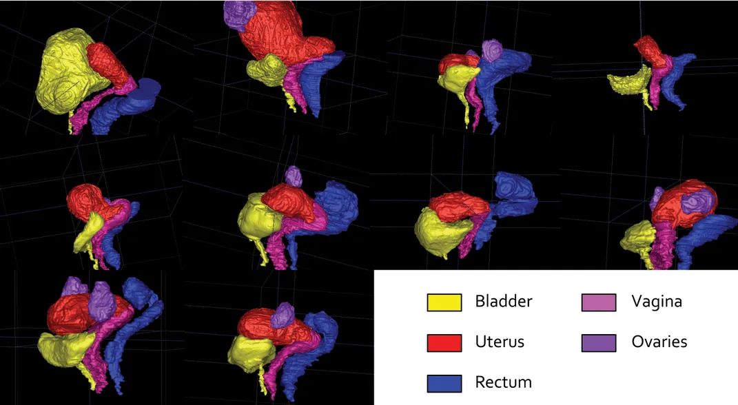 The Quest to Build the First Robotic Vagina