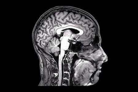 Tomova used a functional magnetic resonance imaging machine to see how participants' brains responded to images of drool-worthy food and social gatherings.

