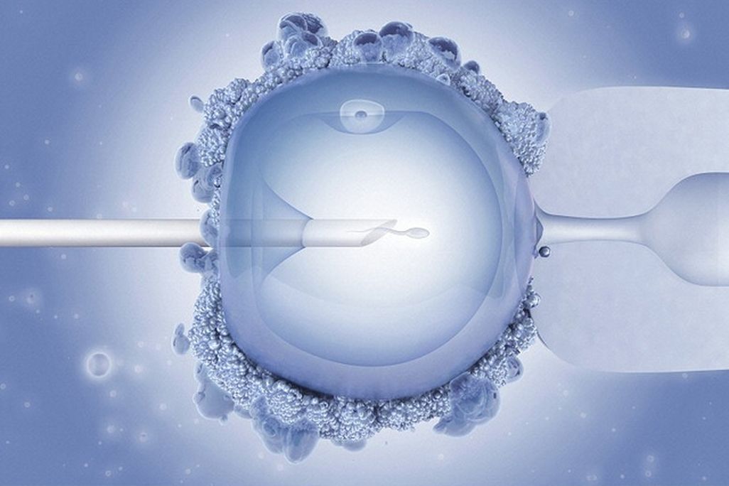 20120725013007in-vitro.jpg