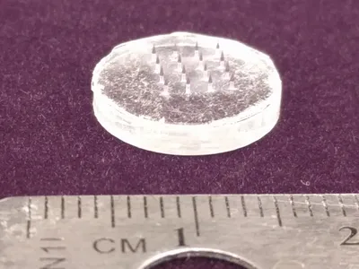 Microneedle patches, like this one that measures about a centimeter across, could be used to deliver nanoparticles when pressed to the skin for two minutes.