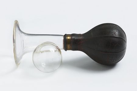 Manual breast pump with black bulb, dating to sometime between 1920 and 1959