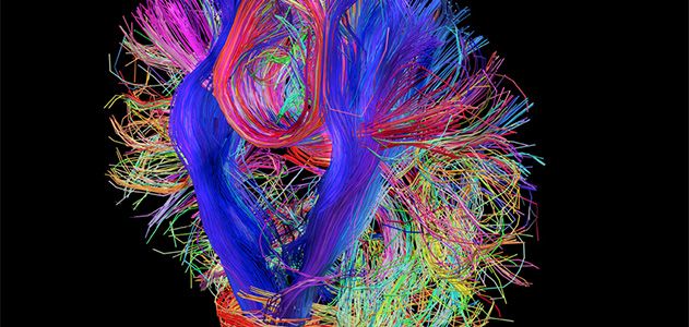 Mapping How the Brain Thinks