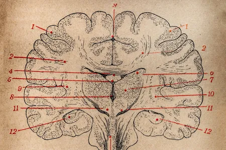 Psychiatric neurosurgery, originally known as psychosurgery, involves operating on the brain to alter its function.