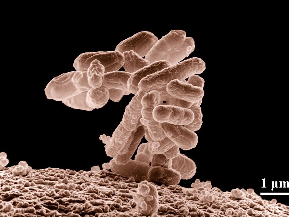 Low-temperature electron micrograph of a cluster of E. coli bacteria, magnified 10,000 times. Each individual bacterium is oblong shaped.