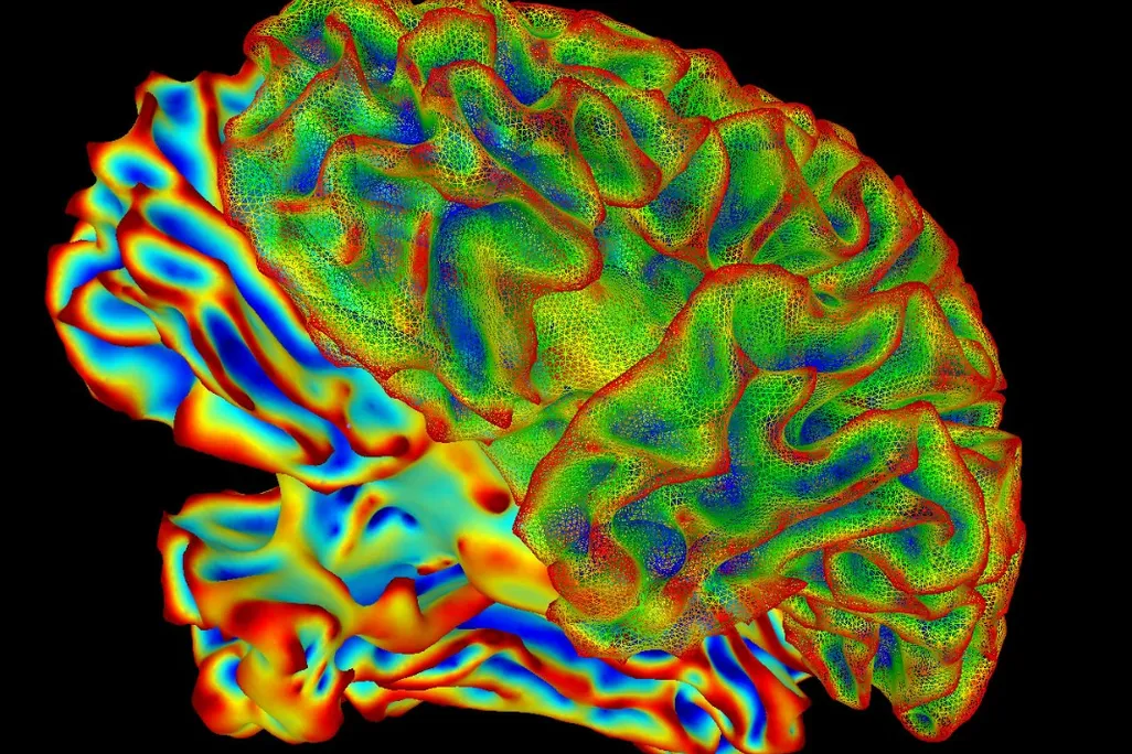 brain image