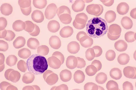 Two types of white blood cells, a neutrophil (top) and a lymphocyte (bottom), in human blood.