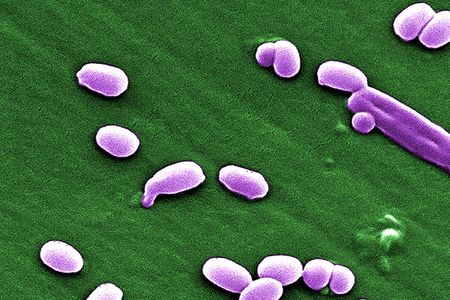 Spores of the Anthrax bacillus. 