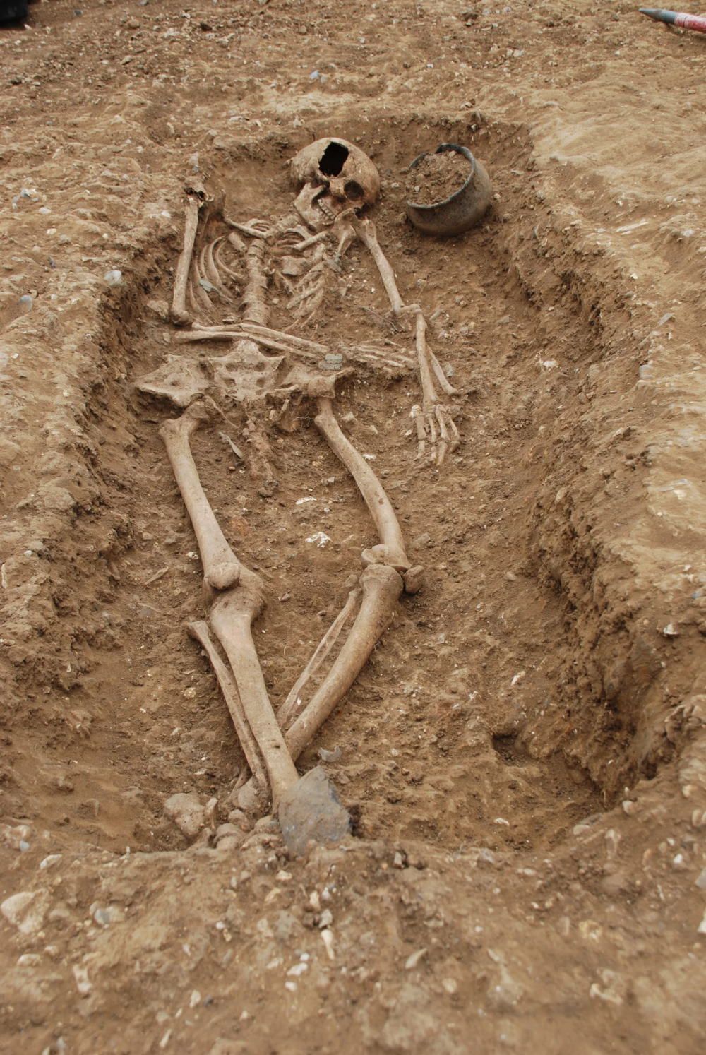 An early medieval English grave with a skeleton, pottery vessel, brooches and a Roman spoon.