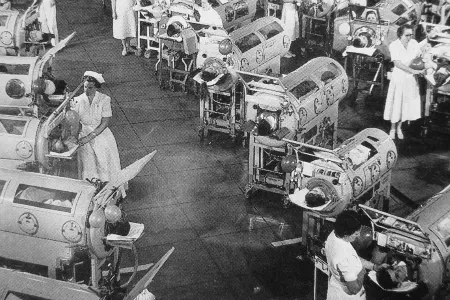 Polio patients in iron lungs in 1952