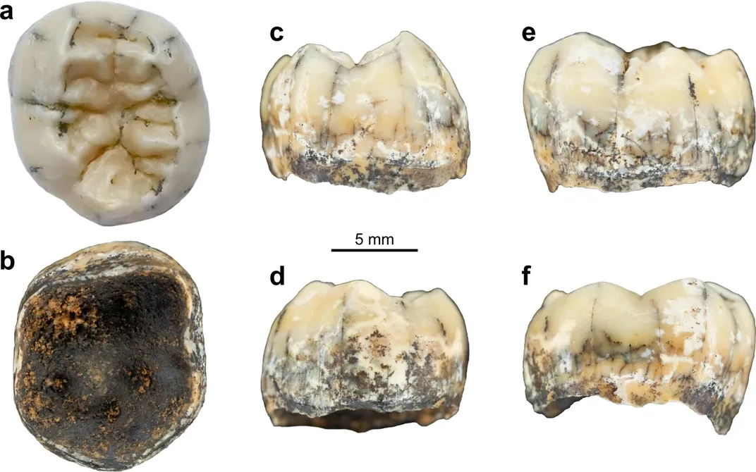 Fossil molar of a Denisovan girl