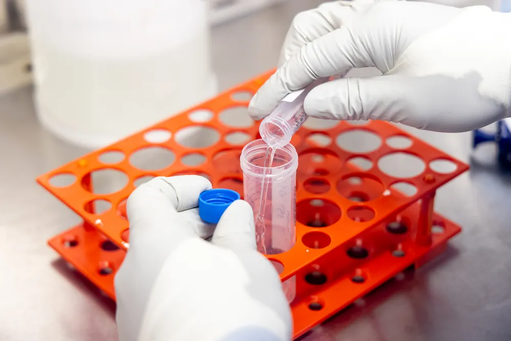 A sample of cerebrospinal fluid