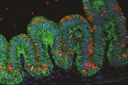 A slice of tissue from a mini human stomach stained with fluorescent dyes