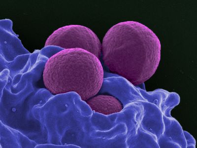 The antibiotic-resistant superbug MRSA