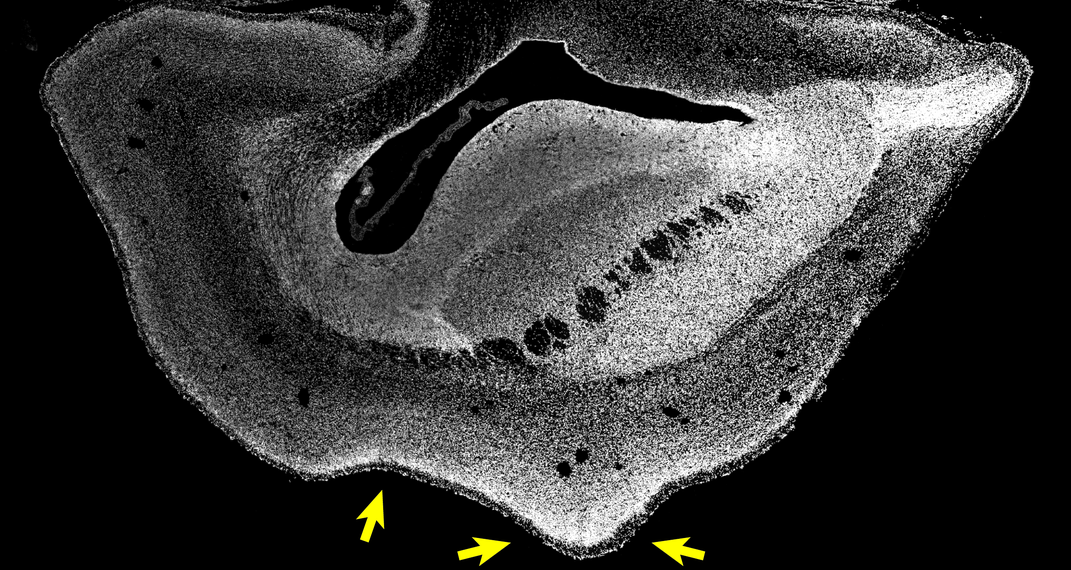 Microscopy image of marmoset brain