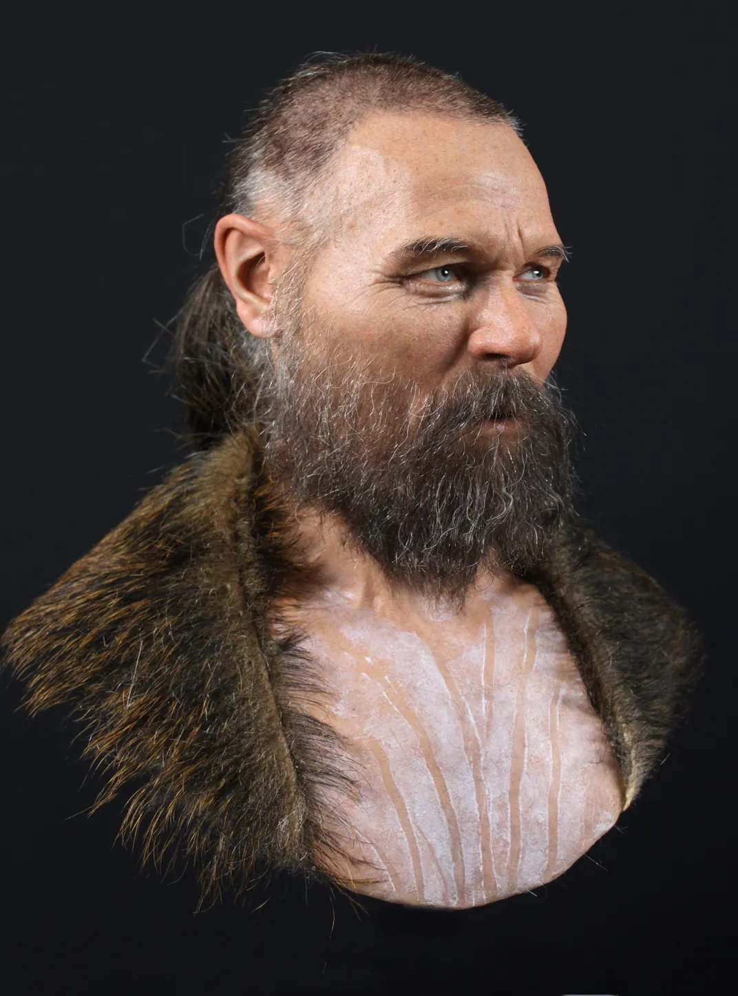 Facial reconstruction of Ludvig
