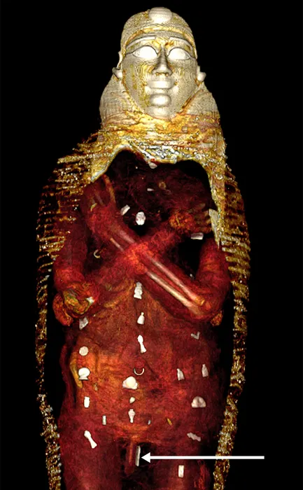 Scan of a mummified body