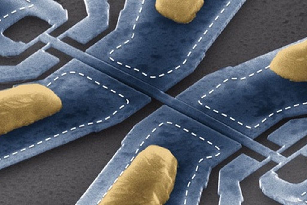 An electron scanning micrograph