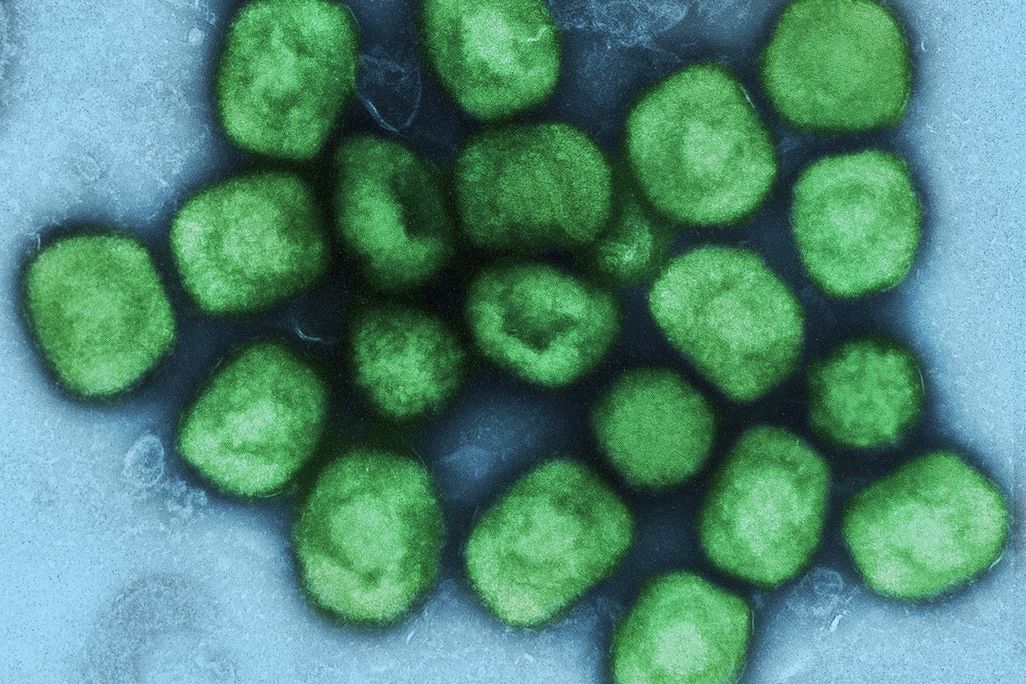 Colorized transmission electron micrograph of monkeypox virus particles (green) cultivated and purified from cell culture