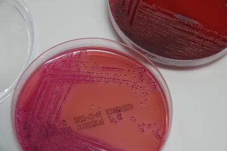 A petri dish with bacteria from a stool sample. The researchers found a number of bacteria, fungi and viruses in fecal samples from children that were altered in children with autism.