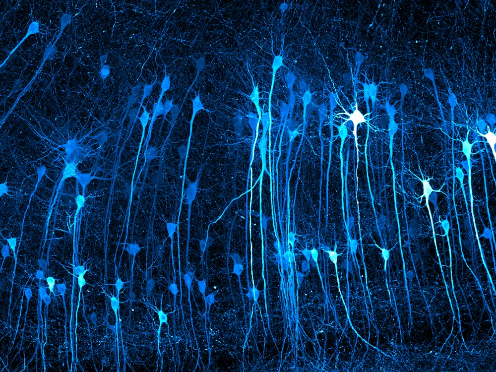 Neurons in mouse brain